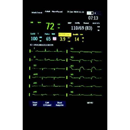 Monitor defibrilla 12L Laerdal MRX